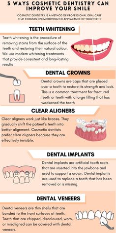 Dental Vocabulary, Dental Tools Names, Dentistry Notes, Dental Scaling, Dental Notes, Dental Content, Dental Post, Dental Ads, Implants Dental