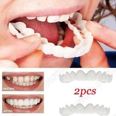 Snap On Upper Lower False Teeth Dental Veneers Dentures Fake Tooth Cover Set USA | eBay Snap On Smile, Misaligned Teeth, Bad Teeth, Teeth Whitening Diy