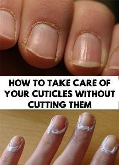 Natural Nail Care, Cuticle Care, Healthy Relationship Tips, Care Care