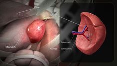 I'm helping many healthcare and medical industries with my medical animation services to improve the understanding capability of medical procedures. It is the mind-blowing process, this will help to medical industry professionals to recognize the medical parts and algorithms, and how it is working with 3D animated representations. Spleen Anatomy, Cell And Molecular Biology, Polycystic Kidneys, Medical Animation, Medical App, Kidney Damage, Organ Transplant, Animation Illustration, Science Illustration