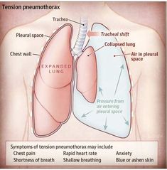 the anatomy of the lungs and its corresponding functions are shown in this diagram, with labels on