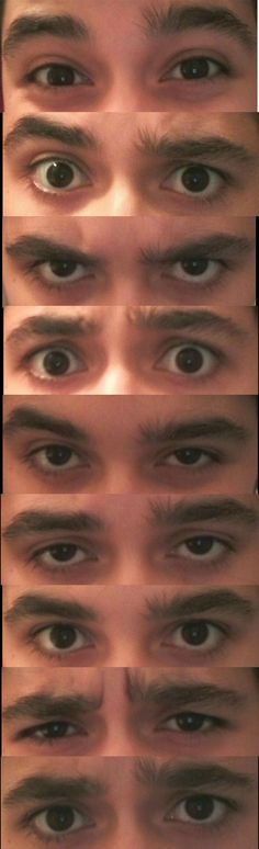 several different pictures of the same person's eyes and their appearance in each photo