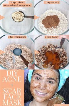 diy face mask for acne scars Diy Face Mask For Acne, Face Mask For Dry Skin, Clear Pimples, Acne Scar Diy, Best Diy Face Mask, Acne Scar Mask, How To Clear Pimples