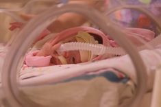 a baby laying in a crib with an oxygen tube attached to it's head