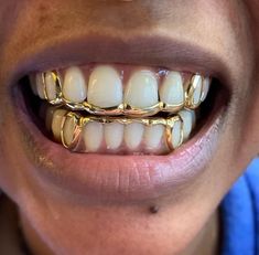 Gold Teeth Grills, Girl Grillz, Teeth Grills, Teeth Gems, Pretty Teeth, Dental Jewelry, Grillz Teeth, Diamond Grillz, Gold Grill