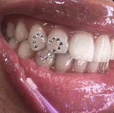 a woman's mouth with white teeth and silver studs on her teeth is shown in close up