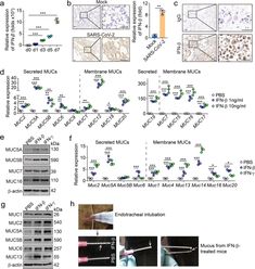 Mucus production stimulated by IFN-AhR signaling triggers hypoxia of COVID-19 | Cell Research Respiratory, Mice, Disease