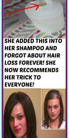 Beautiful  tips Brown Spots On Face, Home Remedies For Hair, Healthy Beauty, Grow Hair, About Hair, Healthy Hair