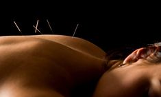 Consultation and One or Two Acupuncture Sessions and Cupping Session at Good Needles Acupuncture (Up to 50% Off) Sinus Congestion Relief, Sinus Congestion, Western Medicine, Neck And Back Pain, Hot Flashes, Chinese Medicine