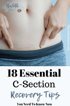 18 Lifesaving C-Section Recovery Tips | This Little Nest C Section Recovery, Parenting Mistakes, Abdominal Surgery, Baby Kicking, Pregnancy Information, Pumping Moms, C Section, Postpartum Recovery