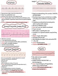 Basic Ekg Rhythms, Cardiac Dysrhythmias Nursing, Ekg Basics Nursing, A Fib Nursing, V Fib Cardiac Rhythms, Irregular Heart Rhythms, Arrythmias Heart, Abc Nursing, Psych Meds Nursing Cheat Sheets