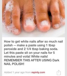 Stained Nails, Skin Care Routine For 20s, Catholic Education, Pinterest Nails, Age Gracefully, Pinterest Diy, Shellac Nails, Beauty Remedies, Foot Care