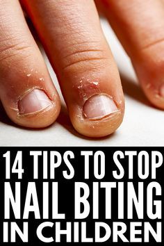 Nail Biting Remedies For Kids, Nail Biting Remedy For Adults, French Tip Nails For Kids, Nail Chewing