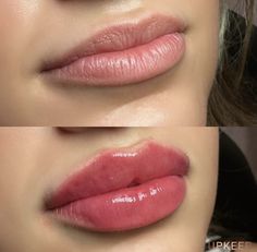 Dream Date, Girls Stuff, Lip Tattoos, Juicy Lips, Medical Spa