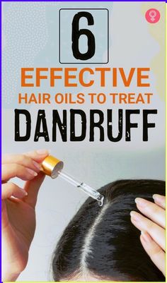 Dandruff Products, Bad Dandruff, Best Hair Oils, Severe Dandruff, Treat Dandruff, Prevent Dandruff, How To Treat Dandruff, Oils For Dandruff, Dandruff Hair