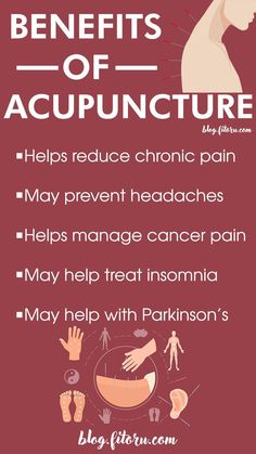 Acupuncture Benefits! Headache Prevention, Happy Sunshine, Uncommon Words, Cold Home Remedies, Homeopathic Medicine, Holistic Healing