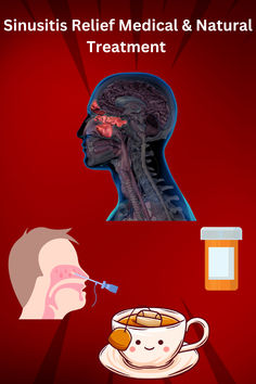 We have all experienced it before that facial pressure and fatigue often accompanied by a headache. Yes, we are talking about sinusitis! Today we will discuss sinusitis. The treatment options both medical & natural. If you find the video informative, please like it and subscribe to the channel for more health information. Thank You! ‪@WellnessWisdomGuide1‬ Health Information, Natural Treatments, Headache, Facial, Medical, Nature