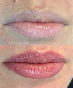 Permablend Pigments Lips, Lip Injections Before And After 0.5ml, Permanente Make-up, Lips Photo, Candy Lips