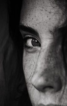 black and white photograph of a woman's face with freckles on her eyes