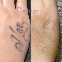 before and after photos of someone's foot tattoo