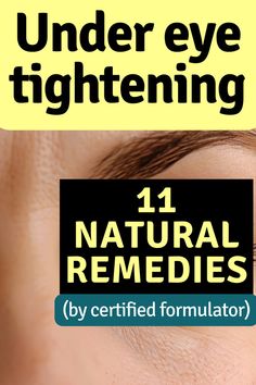 Image of a woman's face. Text reads: Under eye tightening. 11 natural remedies. By certified formulator. Tighten Under Eye Skin, Tighten Stomach, Tighten Facial Skin, Skin Care Home Remedies, Homemade Wrinkle Cream, Skin Tightening Treatments