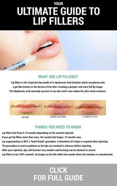 Skin Booster Injection, Skin Care Images, Cosmetic Nursing, Aesthetic Nursing, Dermal Fillers Lips, Derma Fillers, Facial Room, Beauty On A Budget