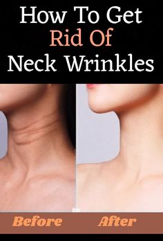 Apply this to remove wrinkles on face quickly >>USE IT THIS WAY<< Wrinkles Under Eyes, Natural Wrinkle Remedies, Massage Routine, Anti Aging Remedies, Get Rid Of Wrinkles, Glow Skincare, Wrinkle Remedies, Anti Aging Skincare Routine