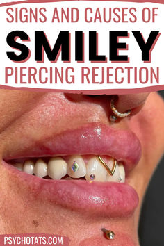 smiley piercing rejection Hidden Smiley Piercing, Piercing Ideas Smiley, Diamond Smiley Piercing, Smiley Piercing With Gap, Frenulum Piercing, Smiley Piercing Fangs Jewelry, Mouth Piercings, Gum Recession, Smiley Piercing