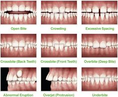 Orthodontic Assistant Study Guides, Dental Assistant Study Guide, Dental Terminology, Dental Notes, Dental Assistant School, Dental Hygienist School, Dental Assistant Study, Registered Dental Hygienist, Dental Hygiene Student