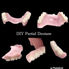 Create Your Perfect Smile with the Affordable DIY Denture Kit | DIY Denture Shop LLC ™ Dental Impression Material, Small Crock Pot, Full Set Acrylic, Affordable Dentures, Temporary Tooth, Denture Adhesive, Missing Tooth, Dental Impressions, Tooth Repair