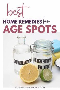 age spots home remedies Liver Spot, Serum For Dark Spots, Dark Neck, Lemon Juice Uses