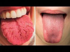 https://gabihealth.com/what-your-tongue-is-trying-to-tell-you-about-your-health/ Detox Your Body, Nail Health, Men’s Health, Organic Health, Oral Hygiene, Ayurveda, Ketogenic Diet, Home Remedies