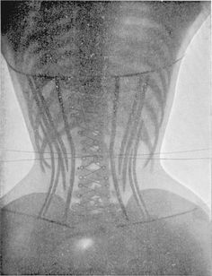 OK. Time to crush those ribs. | X-Rays Of Women Wearing Corsets Corset Photography, Victorian Corsets, X-ray Images, Stella Tennant, Victorian Corset, Corset Training, Fatal Attraction, Dangerous Minds, X Rays