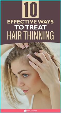 Bonus: Avoid using too many hair products that contain phthalates. #haircare #hair #hairfall Treat Thinning Hair, Thining Hair, Hormonal Imbalances, Health Hair, Hair Thinning, Home Remedies For Hair, Nutritional Deficiencies, Hair Remedies