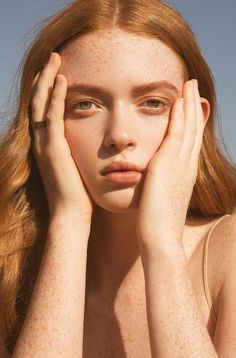 a woman with freckles on her face and hands near her face, looking at the camera