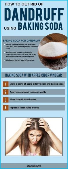 8 Easy and Effective Ways to Use Baking Soda For Dandruff Removal How To Remove Dandruff, Baking Soda For Dandruff, Dandruff Removal, Natural Baking, Baking Soda For Hair, Dandruff Remedy, Baking Soda Water, Hair Care Remedies, Getting Rid Of Dandruff