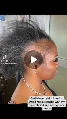 Tiny Weaving With Natural Hair, Short Mohawk Hairstyles For Black Women, Braids For Thinning Edges, Female Low Cut Hairstyles, Shaved Side Hairstyles Black Women, Bald Cornrows, Haircut Designs For Women Black, Minoxidil Before And After Women, Sister Locs With Shaved Sides