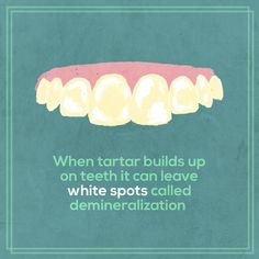 White Spots On Teeth, Dental Fun Facts Did You Know, Dentist Social Media, Best Dental Implants, Dental Images, Dental Hygiene Memes Funny, Dental Memes Humor