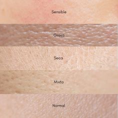 Skin Anatomy, Skin Care Pictures, Skin Facts, Facial Tips, Skin Care Basics, Skin Aesthetics, Facial Aesthetics