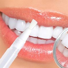 Creative and effective transparent whitening teeth high-strength whitening gel pen teeth whitening agent bleaching agent PH neutral D86 raw material: Deionized water, peroxide, glycerin, Sortbate potassium, polysorbate 20, triethanolamine, carbomer, EDTA instruct: 1. Brush your teeth and use dental floss. 2. Dry the teeth with a paper towel. 3. Twist the bottom of the pen clockwise (to the right) until a small amount of gel flows from the gel chamber to the brush. You may need more distortion th Charcoal Teeth Whitening, Teeth Whitening Pen, Perfect Teeth, Yellow Teeth, Tooth Enamel, Tooth Sensitivity, Best Teeth Whitening, Stained Teeth, Natural Teeth Whitening