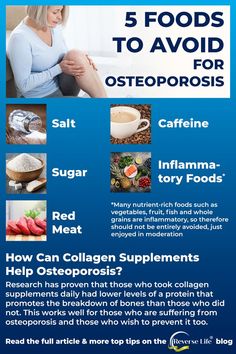 Reverse Osteoporosis Natural, Osteoporosis Diet Plan, Bone Health Exercise, Eat In Moderation, Health Benefits Of Collagen