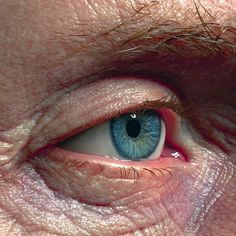 an eye that is blue and has wrinkles on the outside of its iris area