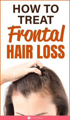 Hair Shedding Remedies, Natural Hair Growth Remedies, Stop Hair Breakage, Frontal Hair, Receding Hairline, Hair Growth Supplement, Home Remedies For Hair, Regrow Hair, Hair Control