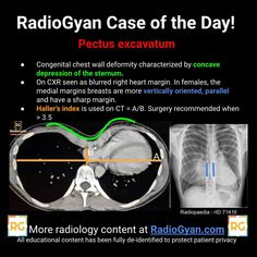 radiology shows the location of an x - ray and how it is made up