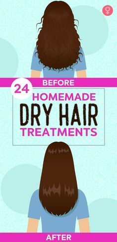 Trend Hair Styles, Healthy Hair Diet, Healthy Hair Colors, Vitamins For Healthy Hair, Healthy Natural Hair Growth, Hair Care Remedies, Hair Scrub, Hair Mistakes, Lifeless Hair