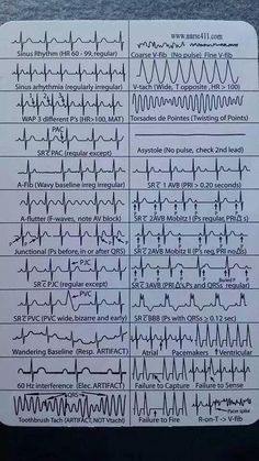 Ekg Rhythms, Nursing Cheat, Nursing Student Tips, Medical Student Study, Cardiac Nursing, Nursing School Survival, Critical Care Nursing, Nursing School Studying