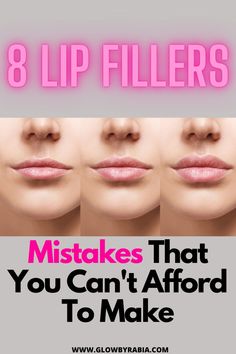 Lip Filler Gone Wrong, Different Types Of Lip Fillers, Where To Inject Lip Filler, 1.5 Ml Lip Filler, Full Syringe Lip Filler Before And After, Mini Lip Filler Before And After, Best Lip Fillers Before And After