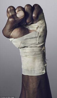 a hand with bandages wrapped around it's wrist and thumb in the middle of its fist