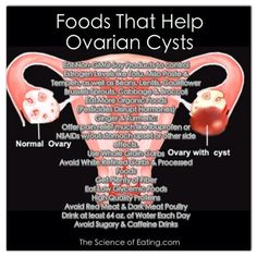 Foods that help ovarian cysts. Polycystic Ovarian Syndrome, Polycystic Ovaries, Be Healthy, Alternative Health, Health Info, Health Issues, The Science, Organic Recipes, Health And Nutrition