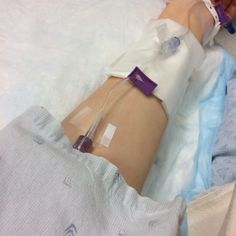 a person laying in bed with an iv attached to their arm and hand on top of it